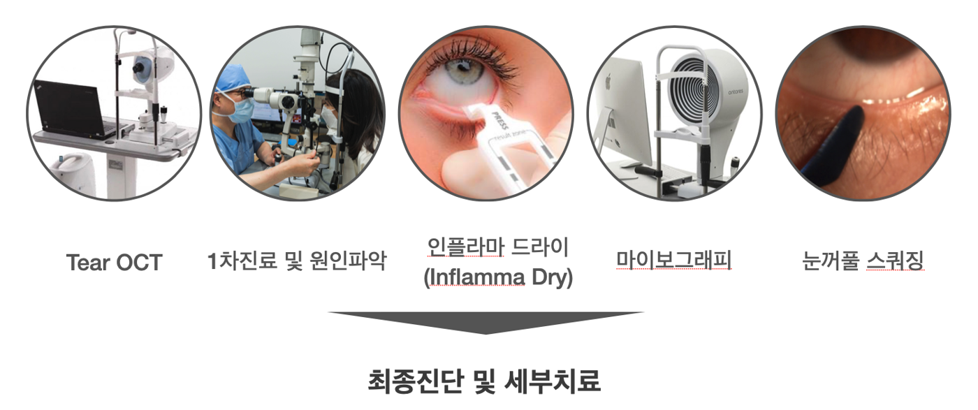 안구건조증 심층진단 프로세스: Tear OCT, 1차 진료 및 원인 파악, 인플라마 드라이(Inflamma Dry), 마이보그래피, 눈꺼풀 스퀴징을 거쳐 최종 진단 및 세부 치료